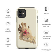 Fungal Giraffe Skull - Tough Case for iPhone®