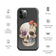 Fungal Human Skull - Tough Case for iPhone®